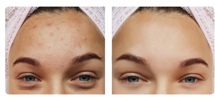 Clay Mask Detox - Food Near Snacks review and price
