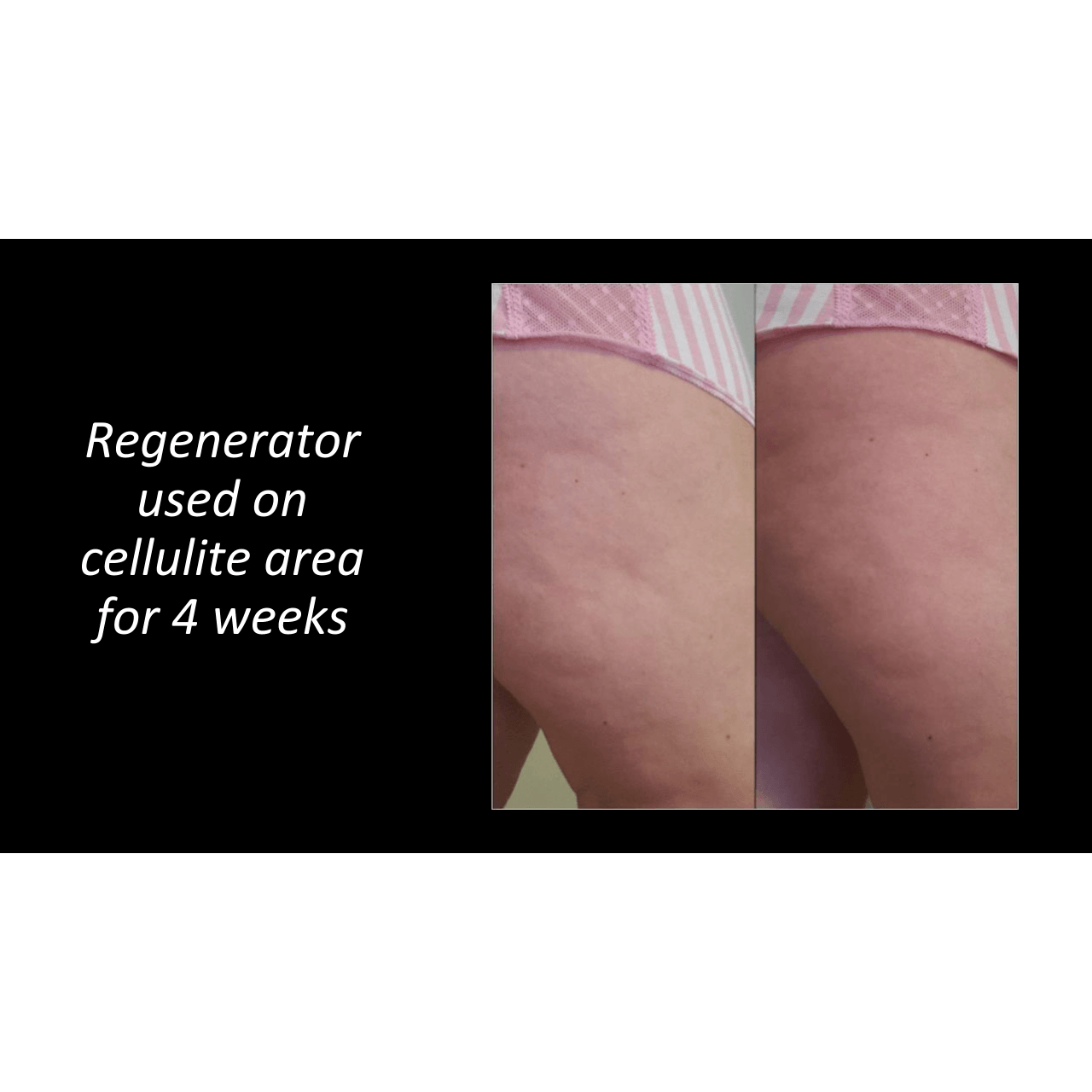 The Regenerator-Apple Cider Vi - Food Near Snacks review and price